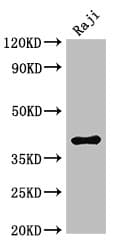 Polyclonal Rabbit anti-Human HMBS / PBGD Antibody (IHC, IF, WB)