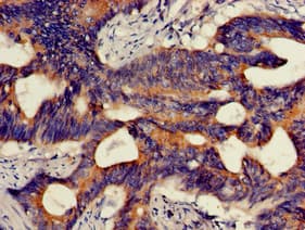 Polyclonal Rabbit anti-Human HMBS / PBGD Antibody (IHC, IF, WB)