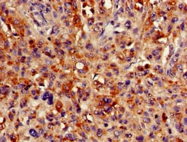 Polyclonal Rabbit anti-Human HMBS / PBGD Antibody (IHC, IF, WB)