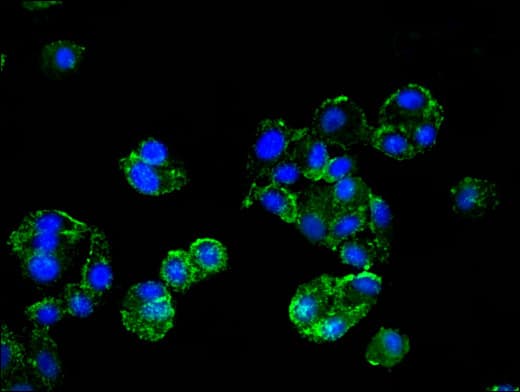 Polyclonal Rabbit anti-Human HMBS / PBGD Antibody (IHC, IF, WB)