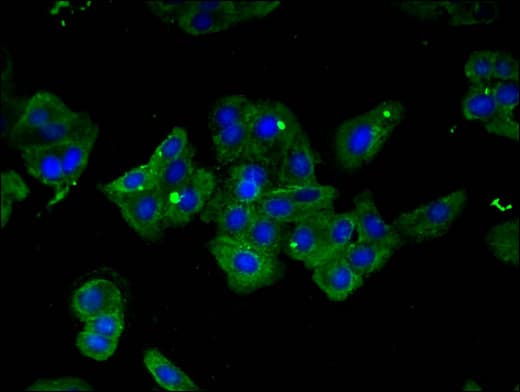 Polyclonal Rabbit anti-Human IRF6 Antibody (IF, WB)