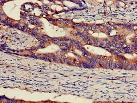 Polyclonal Rabbit anti-Human MAP2K1 / MKK1 / MEK1 Antibody (IHC, WB)