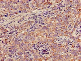 Polyclonal Rabbit anti-Human MAP2K1 / MKK1 / MEK1 Antibody (IHC, WB)