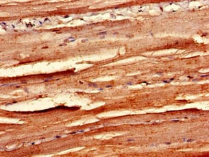 Polyclonal Rabbit anti-Human MAPK12 / ERK6 / SAPK3 Antibody (IHC, IF, WB)