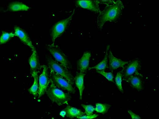 Polyclonal Rabbit anti-Human MAPK12 / ERK6 / SAPK3 Antibody (IHC, IF, WB)