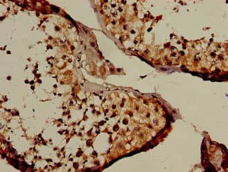 Polyclonal Rabbit anti-Human NUP107 Antibody (IHC, WB)