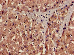 Polyclonal Rabbit anti-Human PROC / Protein C Antibody (IHC, IF)