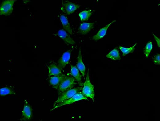 Polyclonal Rabbit anti-Human PROC / Protein C Antibody (IHC, IF)