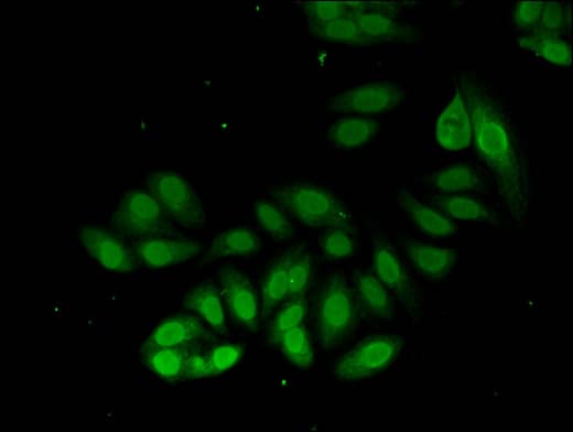 PSMA2 Antibody