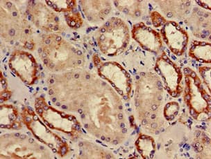 Polyclonal Rabbit anti-Human PSMD9 / 26S Proteasome Antibody (IHC, IF)