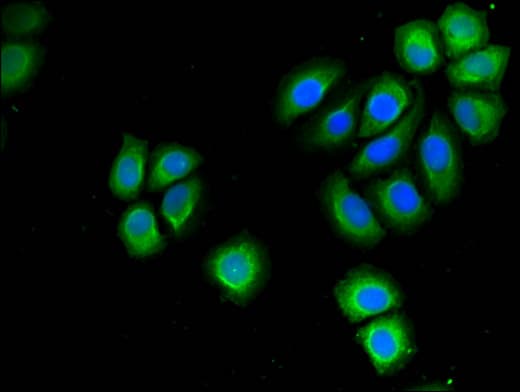 Polyclonal Rabbit anti-Human PSMD9 / 26S Proteasome Antibody (IHC, IF)