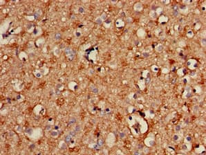 Polyclonal Rabbit anti-Human SPRY2 / Sprouty 2 Antibody (IHC, IF, WB)