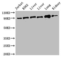 Polyclonal Rabbit anti-Human STAT5B Antibody (IHC, IF, WB)