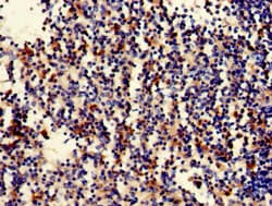 Polyclonal Rabbit anti-Human STAT5B Antibody (IHC, IF, WB)