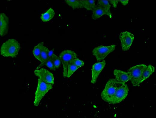 Polyclonal Rabbit anti-Human STAT5B Antibody (IHC, IF, WB)