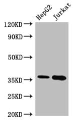 Polyclonal Rabbit anti-Human TS / Thymidylate Synthase Antibody (IF, WB)