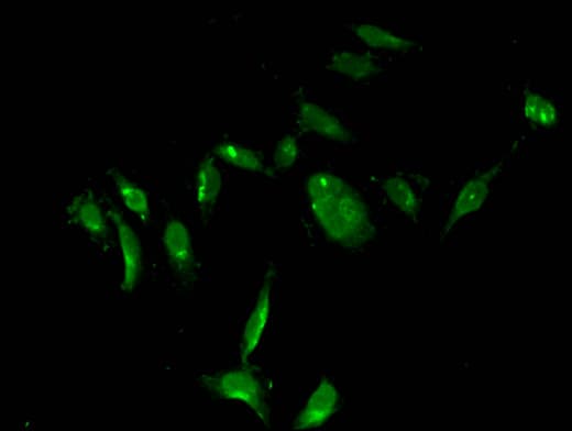 Polyclonal Rabbit anti-Human TS / Thymidylate Synthase Antibody (IF, WB)