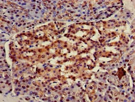 Polyclonal Rabbit anti-Human HSPA8 / HSC70 Antibody (IHC, WB)
