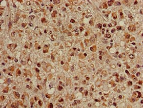 Polyclonal Rabbit anti-Human HSPA8 / HSC70 Antibody (IHC, WB)