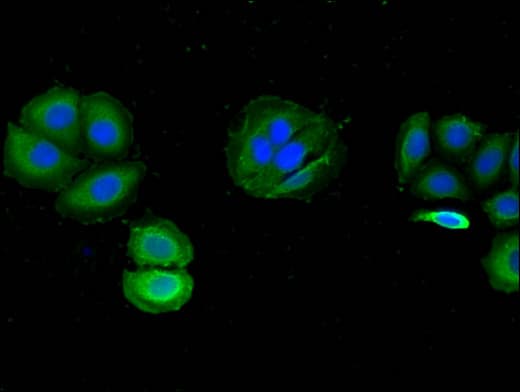 WDR19 Antibody
