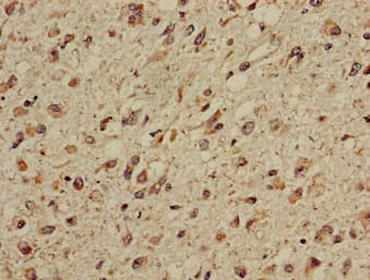 CPT1C Antibody