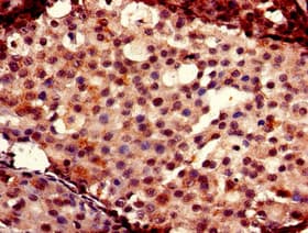 FOXC2 Antibody