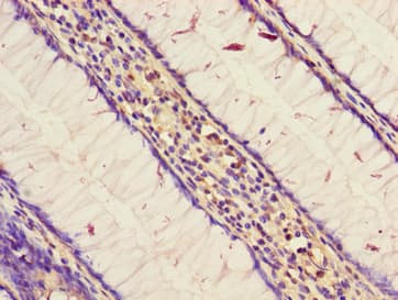 STARD9 Antibody