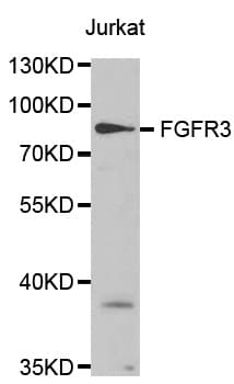 Polyclonal Rabbit anti-Human FGFR3 Antibody (IHC, WB)