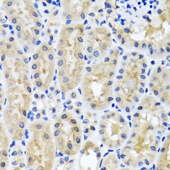SNAP29 Antibody