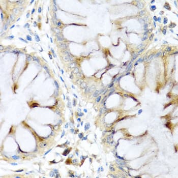 Polyclonal Rabbit anti-Human PI3 / Elafin Antibody (IHC, WB)