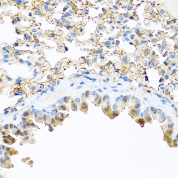 Polyclonal Rabbit anti-Human PI3 / Elafin Antibody (IHC, WB)