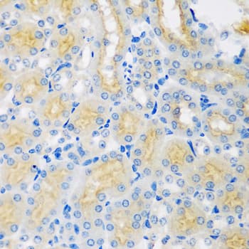 Polyclonal Rabbit anti-Human CYP4A11 Antibody (IHC, WB)