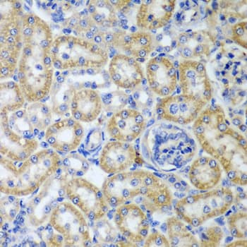 Polyclonal Rabbit anti-Human KITLG / SCF Antibody (IHC, WB)