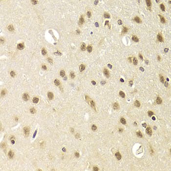 HEXIM1 Antibody