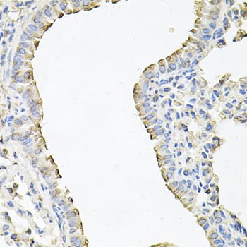 Polyclonal Rabbit anti-Human SCNN1G / ENaC Gamma Antibody (IHC, WB)