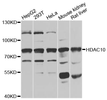 Polyclonal Rabbit anti-Human HDAC10 Antibody (WB)