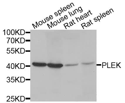 Polyclonal Rabbit anti-Human PLEK / Pleckstrin Antibody (IHC, WB)