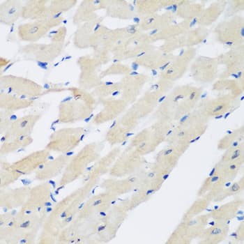 Polyclonal Rabbit anti-Human PLEK / Pleckstrin Antibody (IHC, WB)