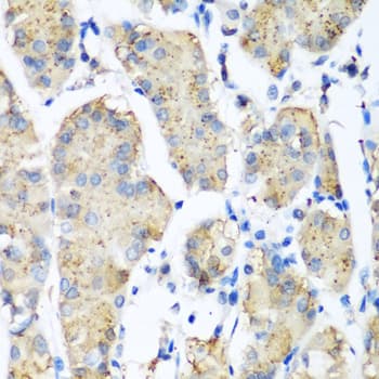 Polyclonal Rabbit anti-Human PLEK / Pleckstrin Antibody (IHC, WB)