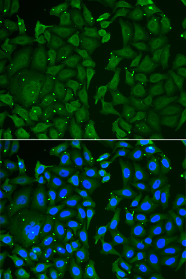 TKT / Transketolase Antibody