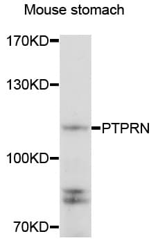 Polyclonal Rabbit anti-Human PTPRN / IA-2 Antibody (IHC, WB)