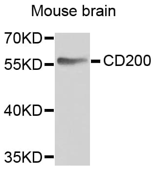 Polyclonal Rabbit anti-Human CD200 Antibody (IHC, WB)