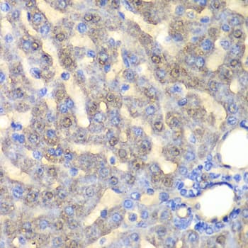 Polyclonal Rabbit anti-Human FAH Antibody (IHC, IF, WB)