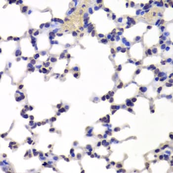 INTS6 Antibody