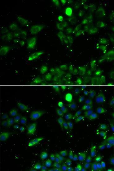 UQCRFS1 Antibody