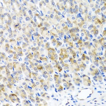 RAD51C Antibody