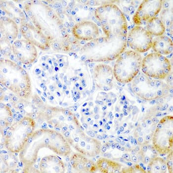 Polyclonal Rabbit anti-Human RLN2 / Relaxin 2 Antibody (IHC, WB)