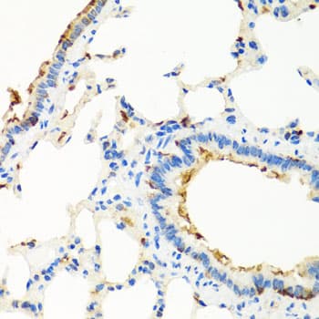 Polyclonal Rabbit anti-Human RGS5 Antibody (IHC, WB)