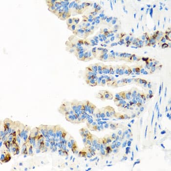 Polyclonal Rabbit anti-Human RGS5 Antibody (IHC, WB)