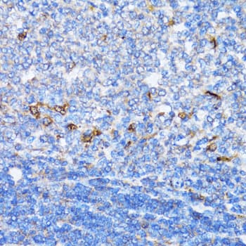 NDE1 Antibody
